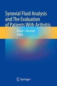 Synovial Fluid Analysis And The Evaluation Of Patients With Arthritis Springer