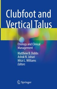 Clubfoot And Vertical Talus: Etiology And Clinical Management Springer