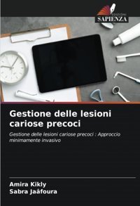 Gestione Delle Lesioni Cariose Precoci: Gestione Delle Lesioni Cariose Precoci : Approccio Minimamente İnvasivo Kikly, Amira Edizioni Sapienza
