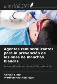 Agentes Remineralizantes Para La Prevencin De Lesiones De Manchas Blancas: Durante Y Despus Del Tratamiento De Ortodoncia Fija Singh, Chhavi Ediciones Nuestro Conocimiento
