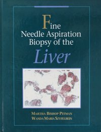 Fine Needle Aspiration Biopsy Of The Liver Szyfelbein, Wanda Crc Press Inc