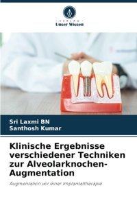 Klinische Ergebnisse Verschiedener Techniken Zur Alveolarknochen-Augmentation: Augmentation Vor Einer Implantattherapie Bn, Sri Laxmi Verlag Unser Wissen