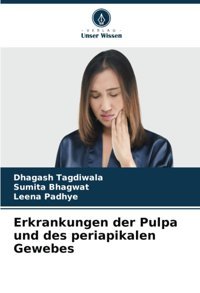Erkrankungen Der Pulpa Und Des Periapikalen Gewebes Tagdiwala, Dhagash Verlag Unser Wissen