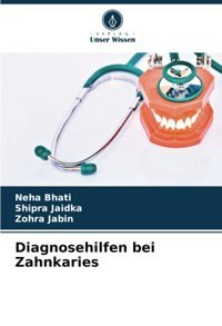 Diagnosehilfen Bei Zahnkaries Bhati, Neha Verlag Unser Wissen