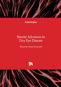 Recent Advances İn Dry Eye Disease Intechopen