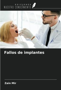 Fallos De İmplantes Mir, Zain Ediciones Nuestro Conocimiento