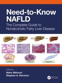 Need-To-Know Nafld: The Complete Guide To Non-Alcoholic Fatty Liver Disease Crc Press Inc