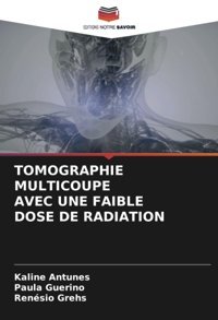 Tomographıe Multıcoupe Avec Une Faıble Dose De Radıatıon Antunes, Kaline Editions Notre Savoir