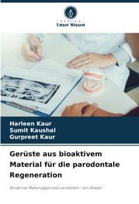 Gerüste Aus Bioaktivem Material Für Die Parodontale Regeneration: Bioaktive Materialgerüste Verstehen Ein Ansatz Kaur, Harleen Verlag Unser Wissen