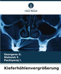 Kieferhöhlenvergröerung: De G., Georgeno Verlag Unser Wissen
