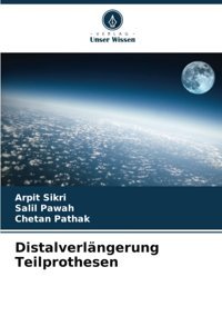 Distalverlngerung Teilprothesen: De Sikri, Arpit Verlag Unser Wissen