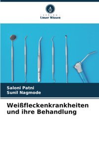 Weifleckenkrankheiten Und İhre Behandlung Patni, Saloni Verlag Unser Wissen