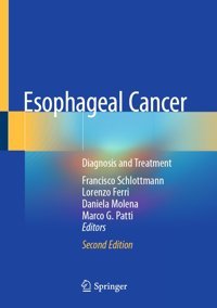 Esophageal Cancer: Diagnosis And Treatment Springer