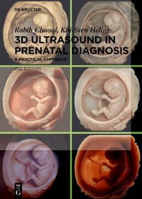 3D Ultrasound İn Prenatal Diagnosis: A Practical Approach Chaoui, Rabih Walter De Gruyter