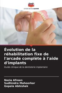 Volution De La Rhabilitation Fixe De L'Arcade Complte L'Aide D'İmplants: Guide Clinique De La Dentisterie İmplantaire Afreen, Nazia Editions Notre Savoir
