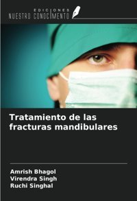 Tratamiento De Las Fracturas Mandibulares Bhagol, Amrish Ediciones Nuestro Conocimiento