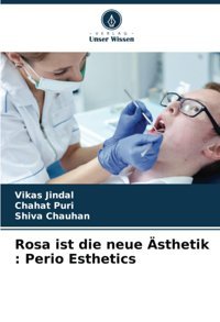 Rosa İst Die Neue Sthetik : Perio Esthetics Jindal, Vikas Verlag Unser Wissen