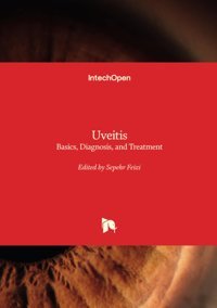 Uveitis: Basics, Diagnosis, And Treatment Intechopen