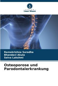 Osteoporose Und Parodontalerkrankung (German Edition) Saradha, Ramakrishna Verlag Unser Wissen