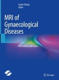 Mrı Of Gynaecological Diseases: Illustrations And Cases Springer