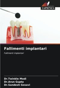 Fallimenti İmplantari: Fallimenti İmplantari Modi, Dr.Twinkle Edizioni Sapienza