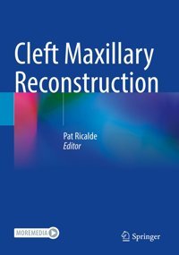 Cleft Maxillary Reconstruction Springer