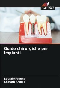 Guide Chirurgiche Per İmpianti Verma, Saurabh Edizioni Sapienza
