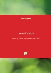 Loss Of Vision Intechopen