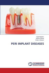 Perı Implant Dıseases: De Ibrahim, Syed Lap Lambert Academic Publishing