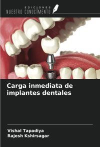 Carga İnmediata De İmplantes Dentales Tapadiya, Vishal Ediciones Nuestro Conocimiento