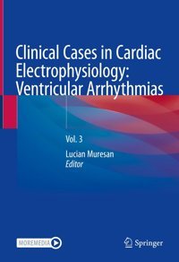 Clinical Cases İn Cardiac Electrophysiology: Ventricular Arrhythmias: Vol. 3 (Clinical Cases İn Cardiac Electrophysiology, 3) Springer