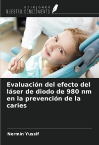 Evaluacin Del Efecto Del Lser De Diodo De 980 Nm En La Prevencin De La Caries Yussif, Nermin Ediciones Nuestro Conocimiento