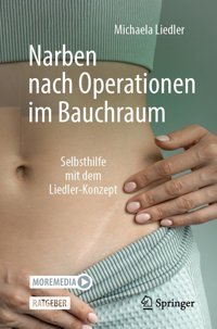 Narben Nach Operationen İm Bauchraum: Selbsthilfe Mit Dem Liedler-Konzept Liedler, Michaela Springer