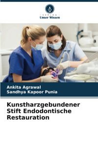 Kunstharzgebundener Stift Endodontische Restauration Agrawal, Ankıta Verlag Unser Wissen