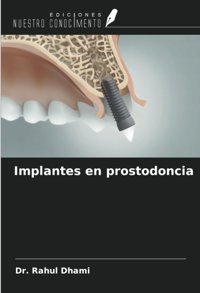 Implantes En Prostodoncia Dhami, Dr. Rahul Ediciones Nuestro Conocimiento