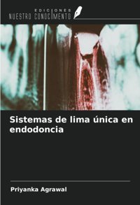 Sistemas De Lima Nica En Endodoncia Agrawal, Priyanka Ediciones Nuestro Conocimiento