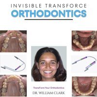 Invisible Transforce Orthodontics Clark, William Austin Macauley Publishers Ltd