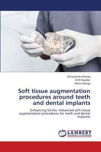 Soft Tissue Augmentation Procedures Around Teeth And Dental İmplants: Enhancing Smiles: Advanced Soft Tissue Augmentation Procedures For Teeth And Dental İmplants Hiranya, Shivananda Lap Lambert Academic Publishing