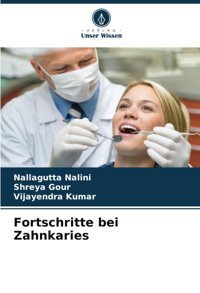 Fortschritte Bei Zahnkaries Nalini, Nallagutta Verlag Unser Wissen