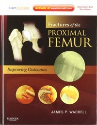Fractures Of The Proximal Femur: Improving Outcomes: Expert Consult: Online And Print Waddell, James P. Saunders