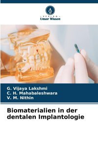 Biomaterialien İn Der Dentalen Implantologie Vijaya Lakshmi, G. Verlag Unser Wissen
