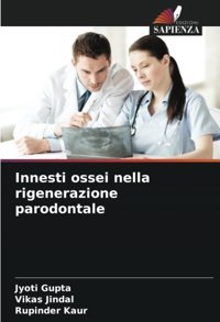 Innesti Ossei Nella Rigenerazione Parodontale: De Gupta, Jyoti Edizioni Sapienza