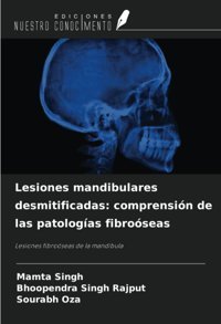 Lesiones Mandibulares Desmitificadas: Comprensin De Las Patologas Fibroseas: Lesiones Fibroseas De La Mandbula Singh, Mamta Ediciones Nuestro Conocimiento