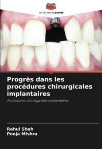 Progrs Dans Les Procdures Chirurgicales İmplantaires: Procdures Chirurgicales İmplantaires Shah, Rahul Editions Notre Savoir