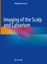 Imaging Of The Scalp And Calvarium Demaerel, Philippe Springer Verlag