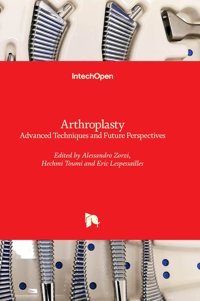 Arthroplasty Advanced Techniques And Future Perspectives Intechopen