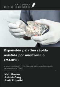 Expansin Palatina Rpida Asistida Por Minitornillo (Marpe): Y Su Comparacin Con La Expansin Maxilar Rpida Convencional (Rme) Banka, Kirti Ediciones Nuestro Conocimiento