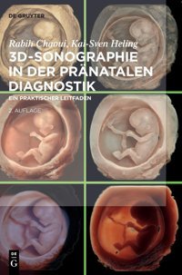 3D-Sonographie İn Der Prnatalen Diagnostik: Ein Praktischer Leitfaden Chaoui, Rabih De Gruyter