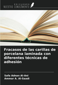 Fracasos De Las Carillas De Porcelana Laminada Con Diferentes Tcnicas De Adhesin Al-Ani, Safa Adnan Ediciones Nuestro Conocimiento