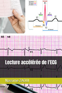 Lecture Acclre De L'Ecg Zaouı, Prof Nassime Independently Publıshed